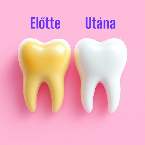 Dohányzás Elleni Fogfehérítő Krém 100g