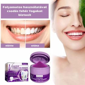 Eelhoe V34 Fogfehérítő Por - 30 g