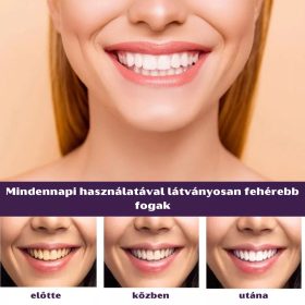 Eelhoe Lila Fogfehérítő Krém - 50 ml