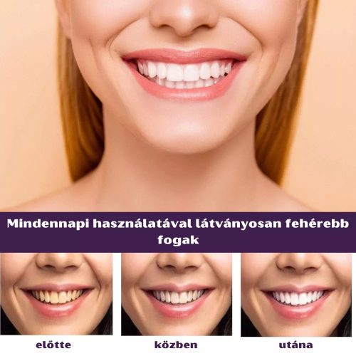 Eelhoe Lila Fogfehérítő Krém - 50 ml